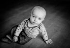 alopecia bambini
